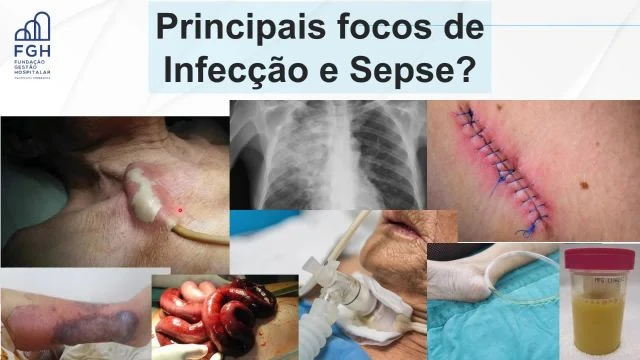 Vídeo Treinamento SEPSE